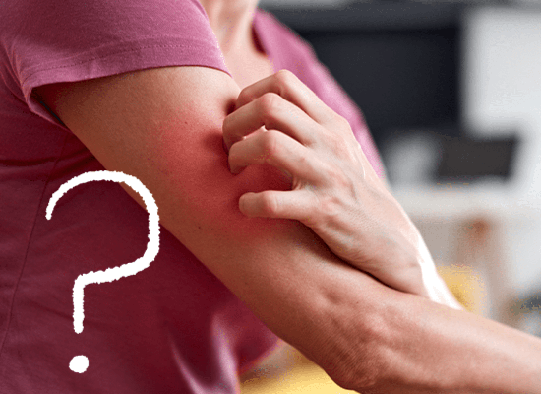 woman itching her arm (actor portrayal)