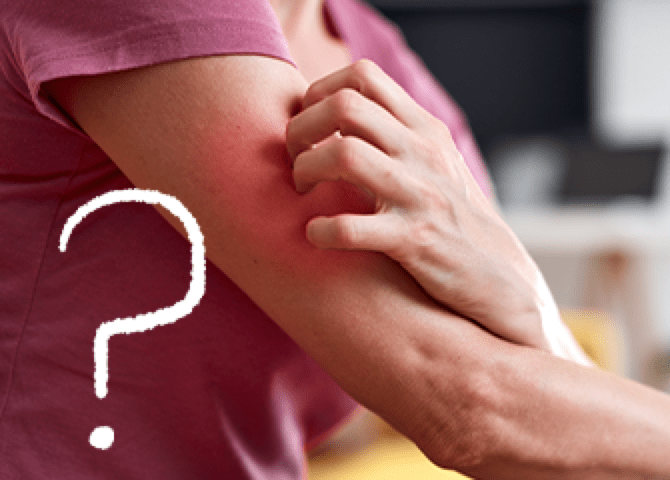 a woman scratching her arm (actor portrayal)